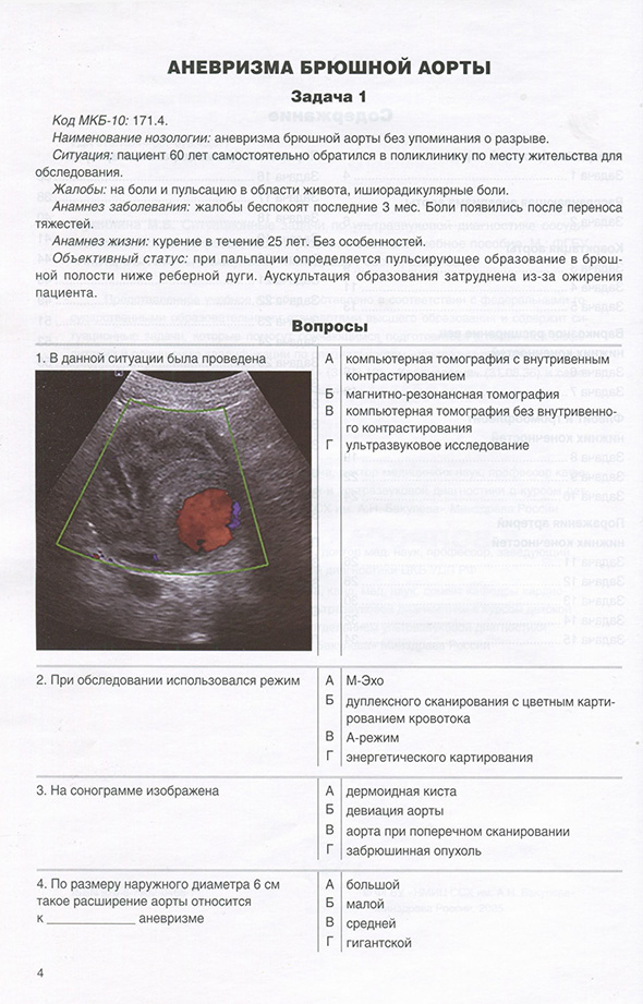 Аневризма брюшной аорты