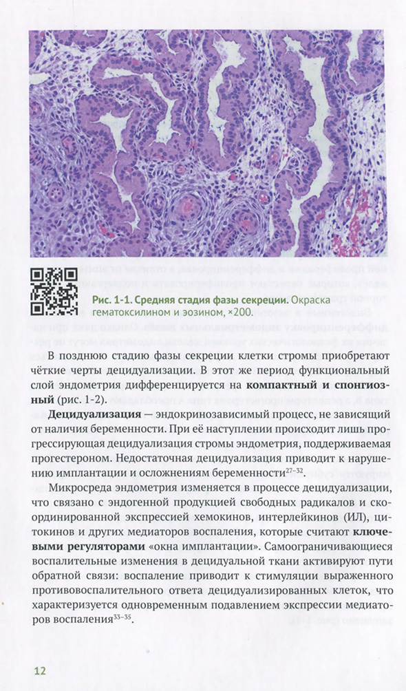 Средняя стадия фазы секреции. Окраска