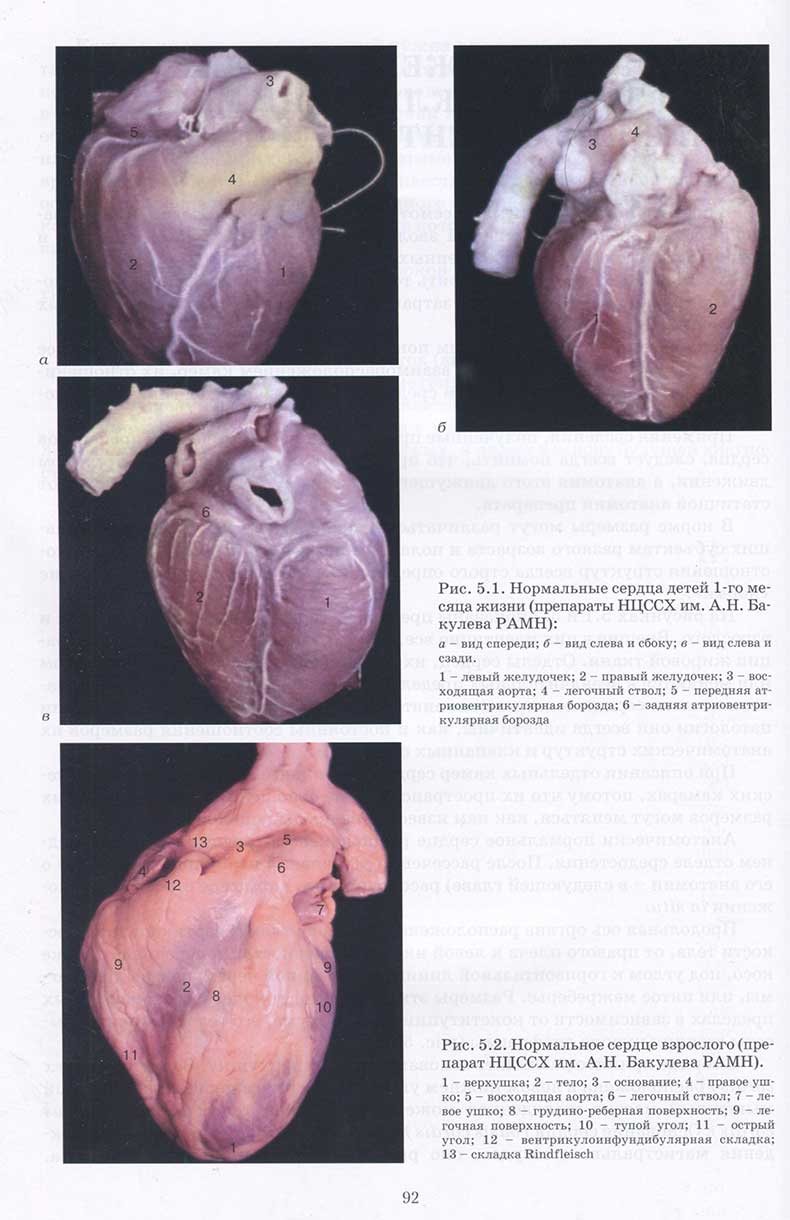 Рис. 5.1. Нормальные сердца детей 1-го месяца жизни 