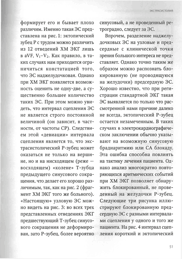 Пример страницы из книги "Холтеровское мониторирование при аритмиях" Пример страницы из книги "Холтеровское мониторирование при аритмиях"