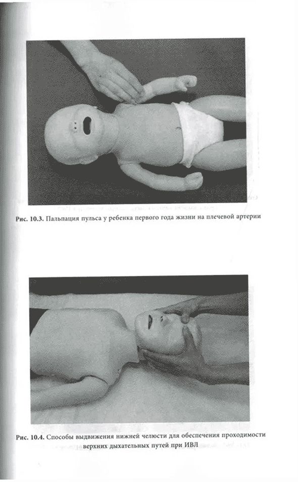 Пальпация пульса у ребенка первого года жизни на плечевой артерии Пальпация пульса у ребенка первого года жизни на плечевой артерии