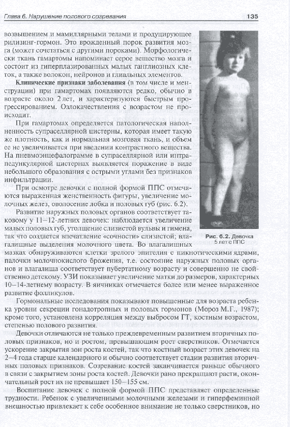 Девочка 5 лет с ППС Девочка 5 лет с ППС
