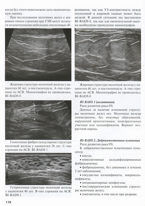 Жировая структура молочной железы у пациентки 60 лет. в постменопаузе. Жировая структура молочной железы у пациентки 60 лет. в постменопаузе.