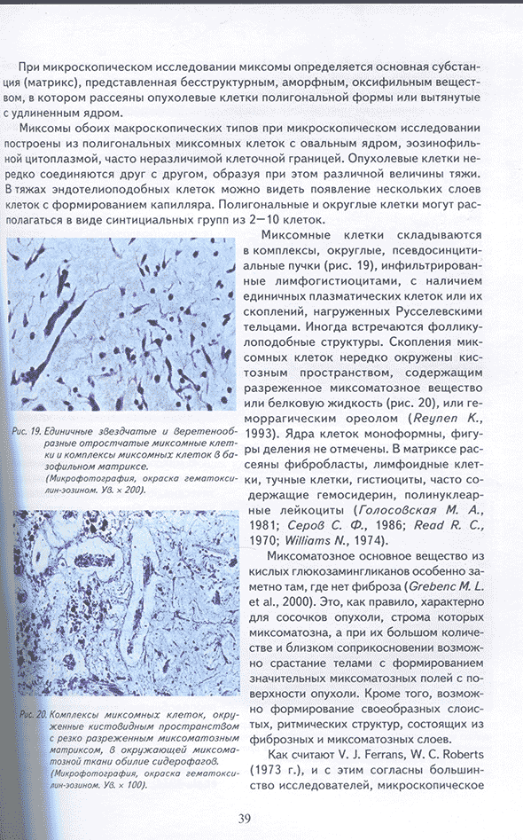 Комплексы миксомных клеток