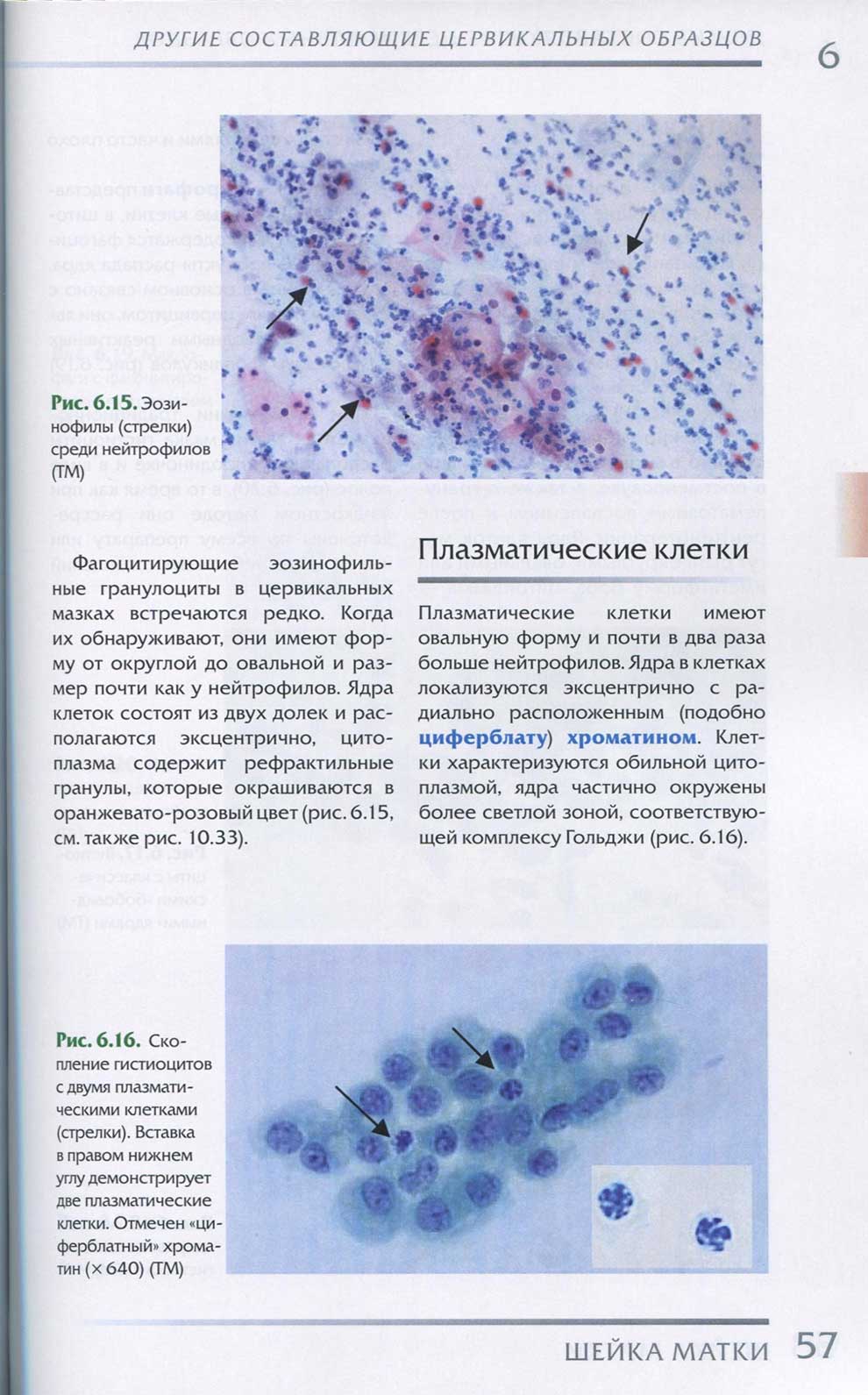 Рис. 6.15. Эозинофилы (стрелки) среди нейтрофилов (ГМ)