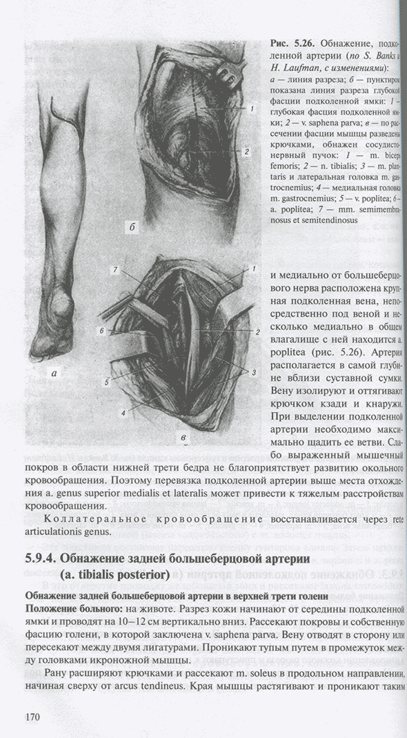 Обнажение подколенной артерии
