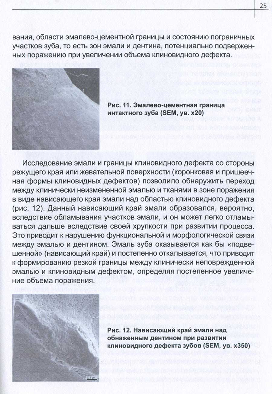 Рис. 11. Эмалево-цементная граница интактного зуба (SEM, ув. х20)
