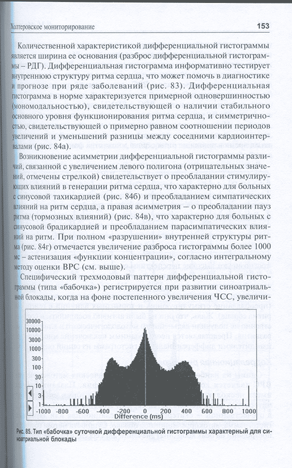 Тип «бабочка» суточной дифференциальной гистограммы характерный для сильной блокады