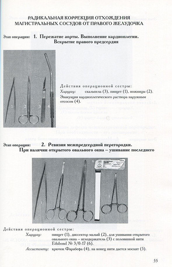 Радикальная коррекция отхождения магистральных сосудов от правого желудочка Радикальная коррекция отхождения магистральных сосудов от правого желудочка