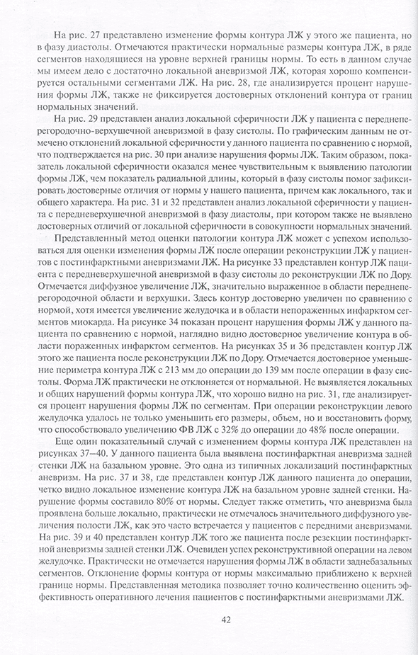 Пример страницы из книги "Ишемическое ремоделирование левого желудочка (методологические аспекты, вопросы диагностики и лечения)" - Л. А. Бокерия, Ю. И. Бузиашвили, И. В. Ключникова Пример страницы из книги "Ишемическое ремоделирование левого желудочка (методологические аспекты, вопросы диагностики и лечения)" - Л. А. Бокерия, Ю. И. Бузиашвили, И. В. Ключникова