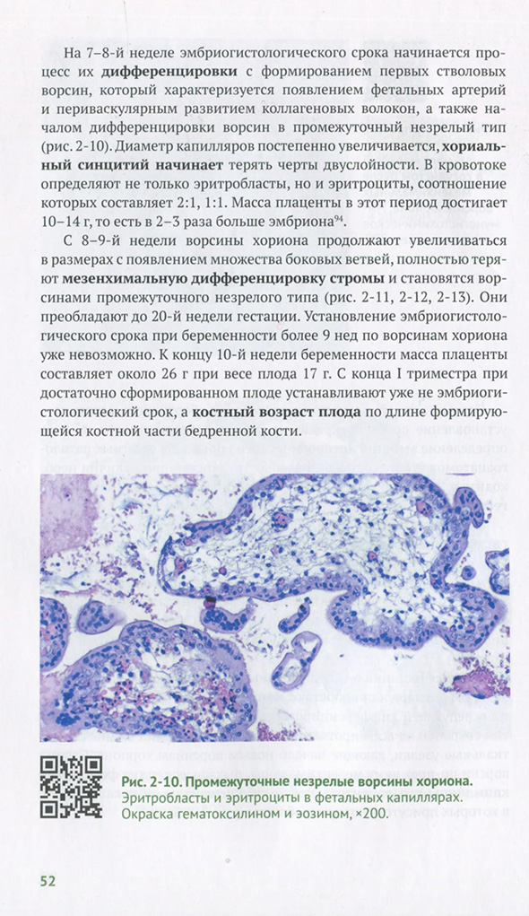 Промежуточные незрелые ворсины хориона