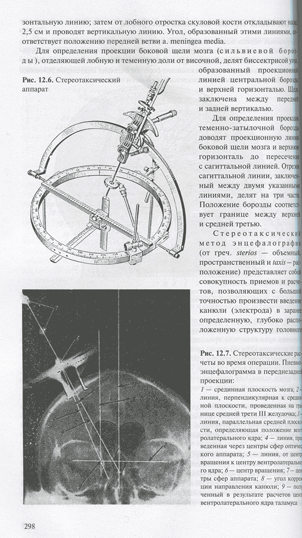 Стереотаксический аппарат