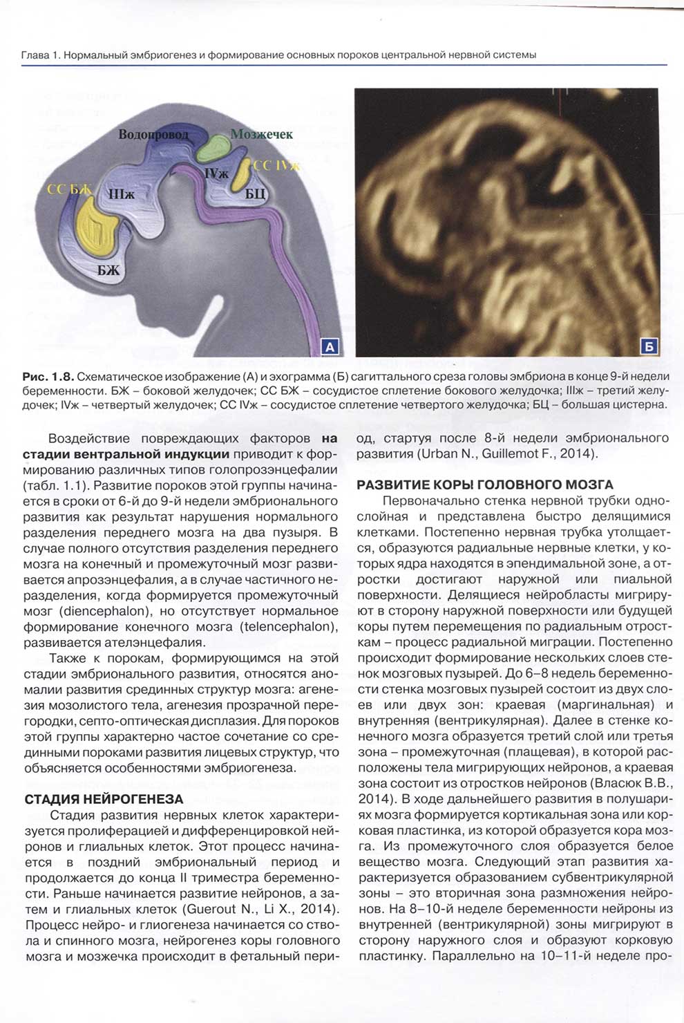 Схематическое изображение (А) и эхограмма (Б) сагиттального среза головы эмбриона в конце 9-й недели