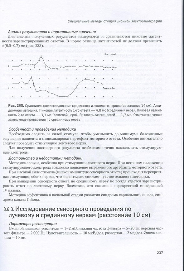 Сравнительное исследование срединного и локтевого нервов (расстояние 14 см).