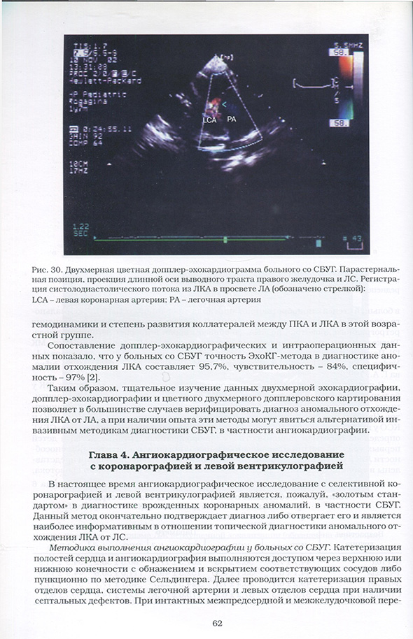 Двухмерная цветная допплер-эхокардиограмма больного со СБУГ. Двухмерная цветная допплер-эхокардиограмма больного со СБУГ.