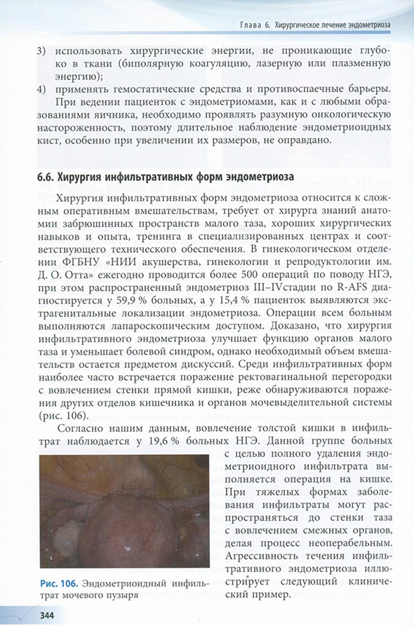Рис. 106. Эндометриоидный инфильтрат мочевого пузыря Рис. 106. Эндометриоидный инфильтрат мочевого пузыря