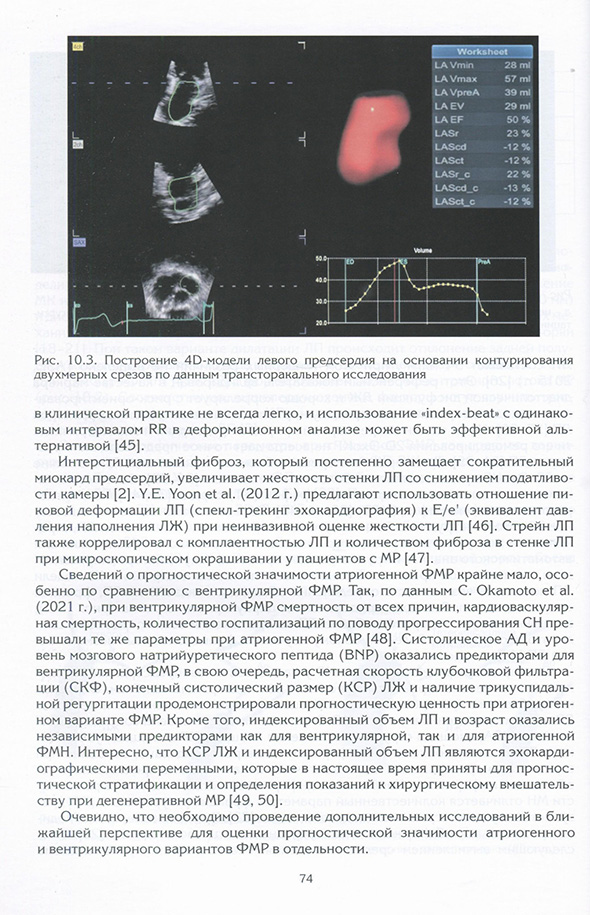 Построение 4D-модели левого предсердия на основании