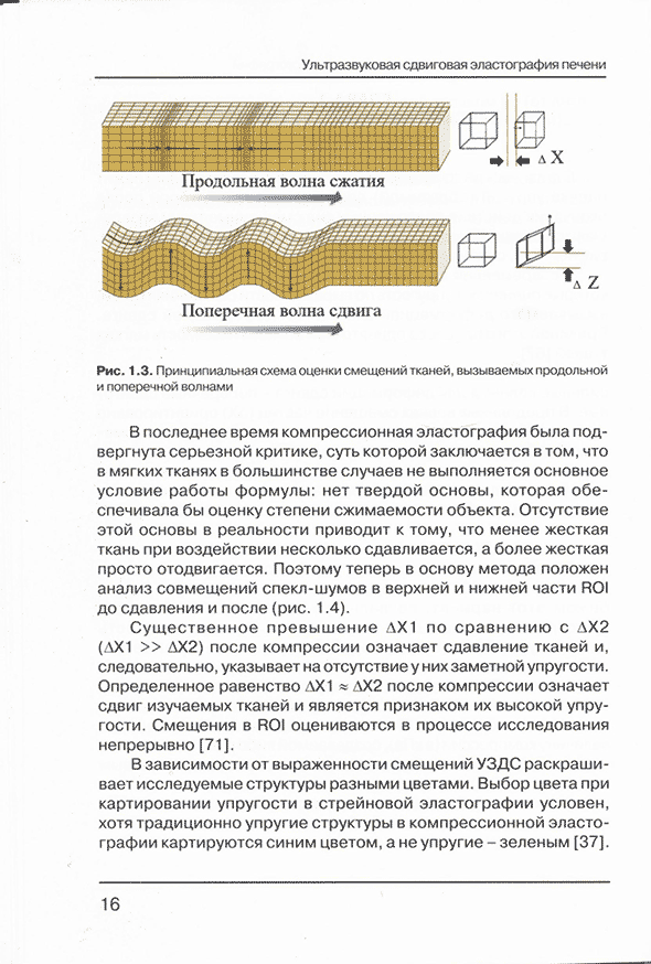 Принципиальная схема оценки смещений тканей, вызываемых продольной и поперечной волнами Принципиальная схема оценки смещений тканей, вызываемых продольной и поперечной волнами