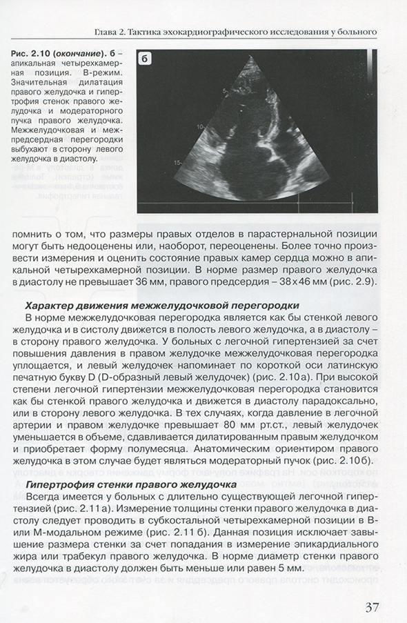 Тактика эхокардиографического исследования у больного Тактика эхокардиографического исследования у больного