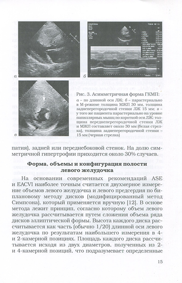 Асимметричная форма ГКМП