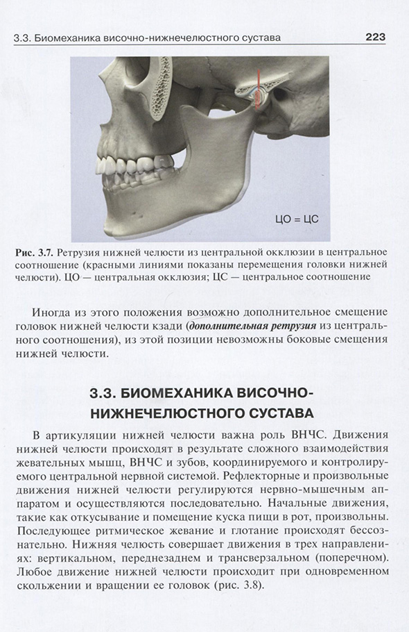 Ретрузия нижней челюсти из центральной окклюзии Ретрузия нижней челюсти из центральной окклюзии