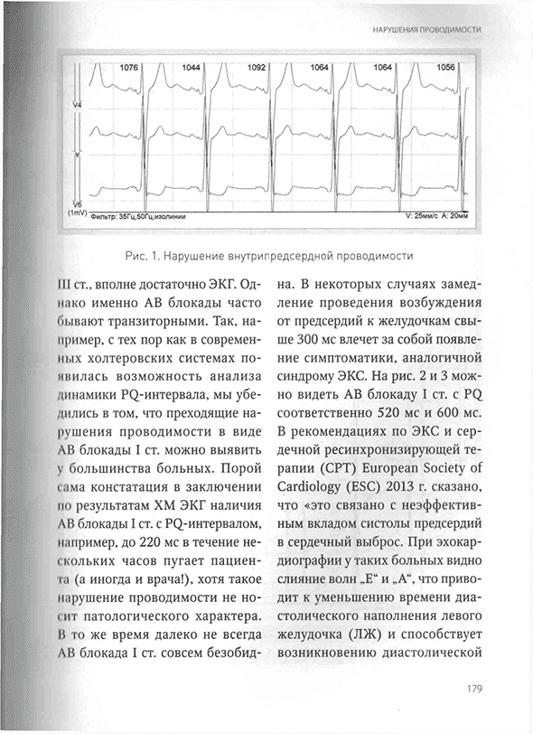 Пример страницы из книги "Холтеровское мониторирование при аритмиях" Пример страницы из книги "Холтеровское мониторирование при аритмиях"