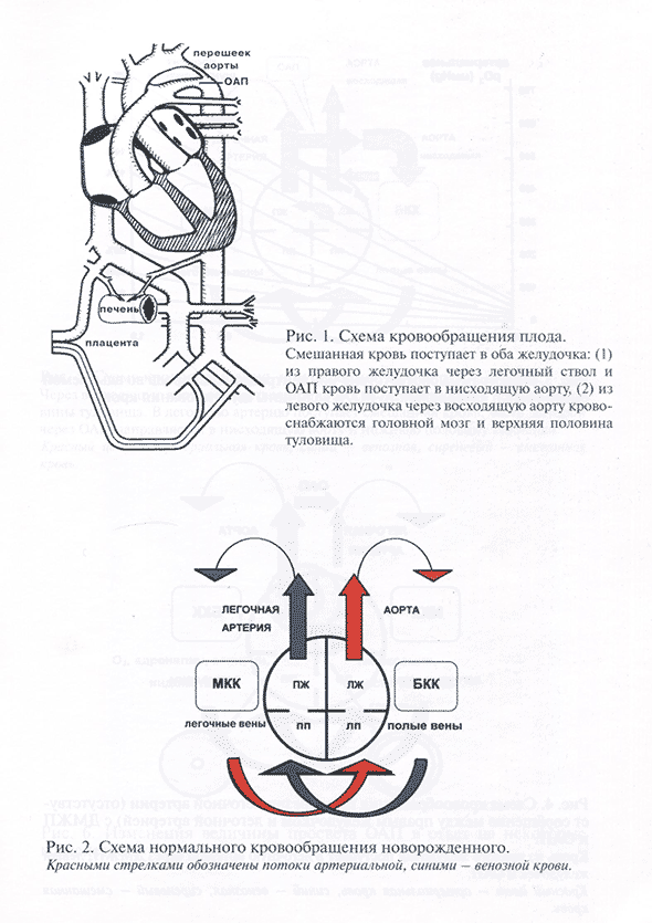 . Схема нормального кровообращения новорожденного. . Схема нормального кровообращения новорожденного.