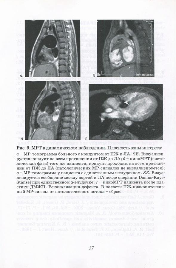 MPT в динамическом наблюдении.