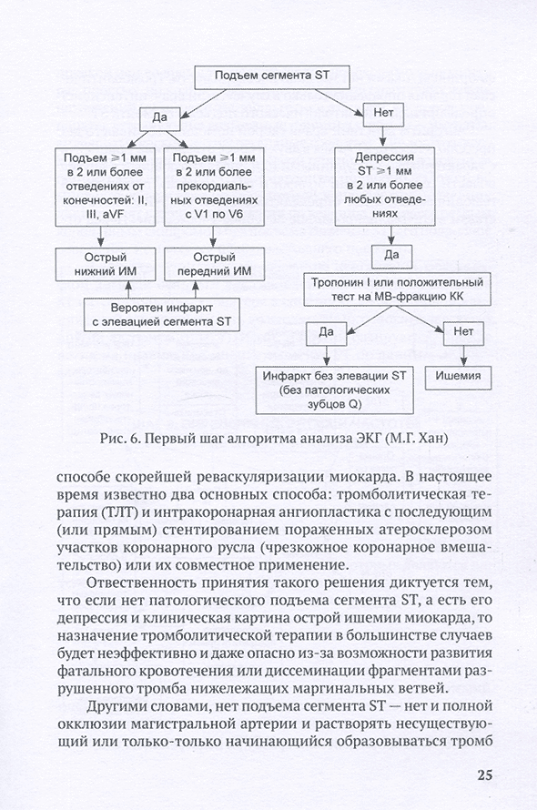 Первый шаг алгоритма анализа ЭКГ