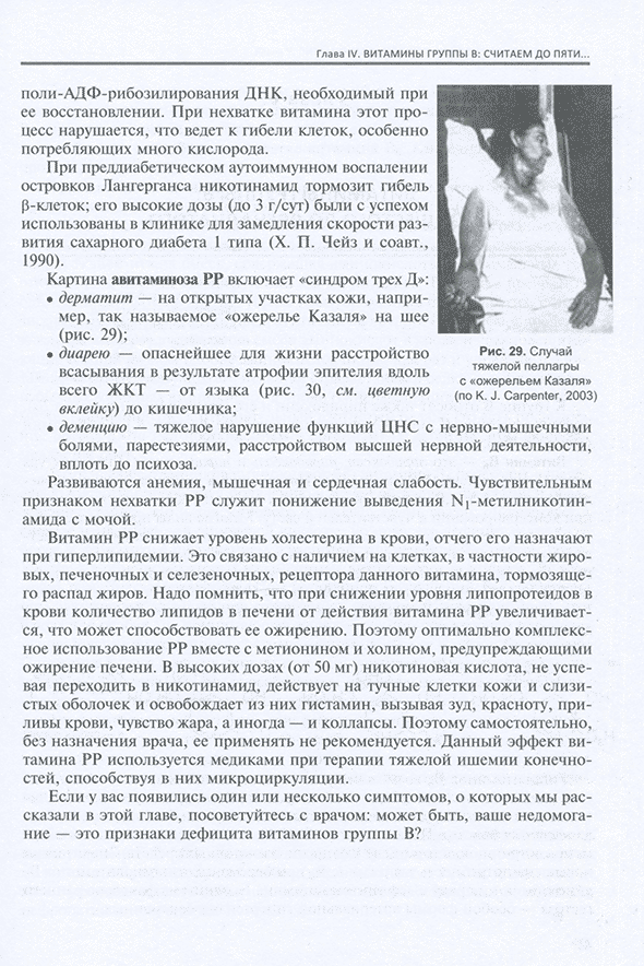 Рис. 29. Случай тяжелой пеллагры с «ожерельем Казаля» (по К. J. Carpenter. 2003) Рис. 29. Случай тяжелой пеллагры с «ожерельем Казаля» (по К. J. Carpenter. 2003)