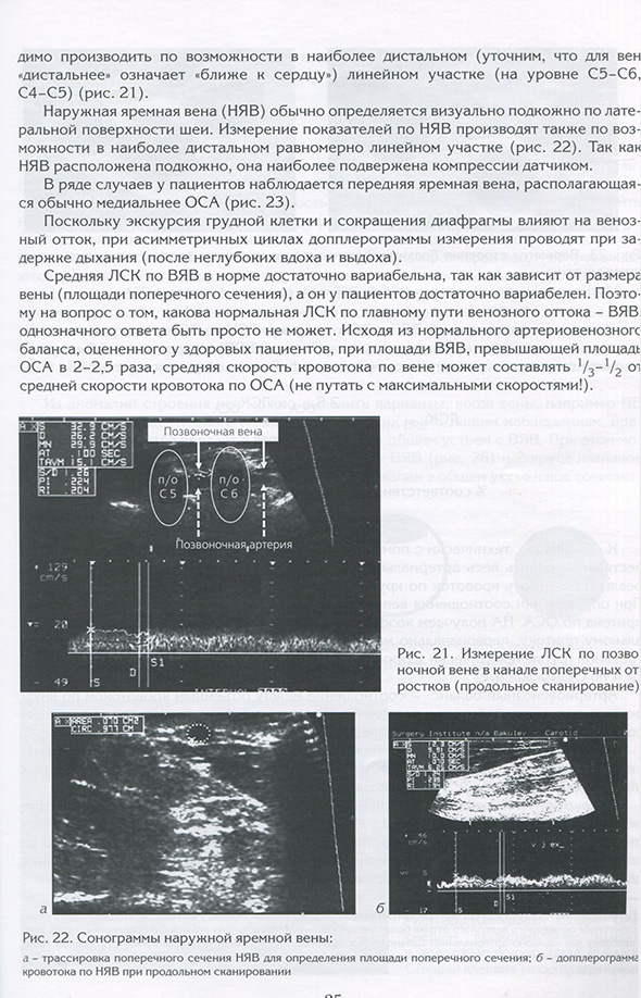 Сонограммы наружной яремной вены Сонограммы наружной яремной вены