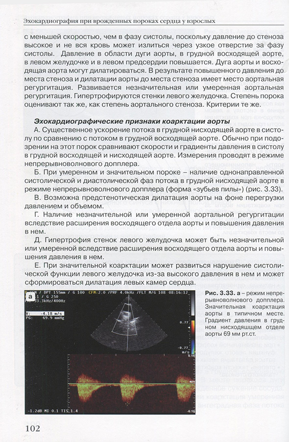 а - режим непрерывноволнового допплера. а - режим непрерывноволнового допплера.