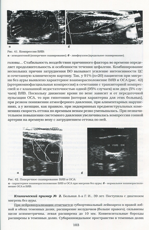 . Поперечное сканирование ВЯВ и ОСА . Поперечное сканирование ВЯВ и ОСА