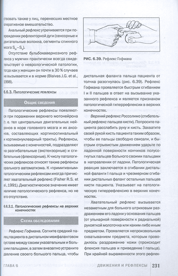 Рефлекс Гофмана