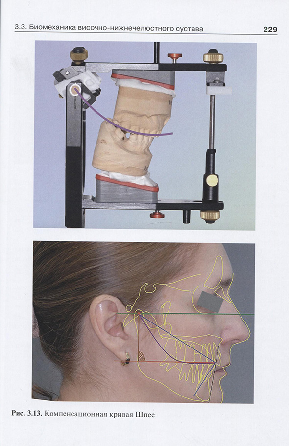Компенсационная кривая Шнее Компенсационная кривая Шнее