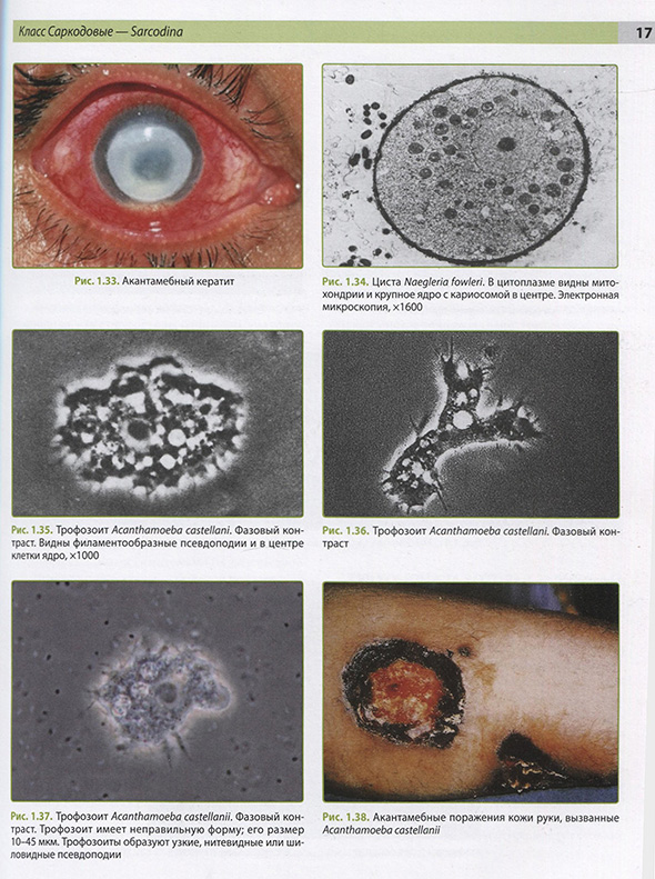 Трофозит Трофозит