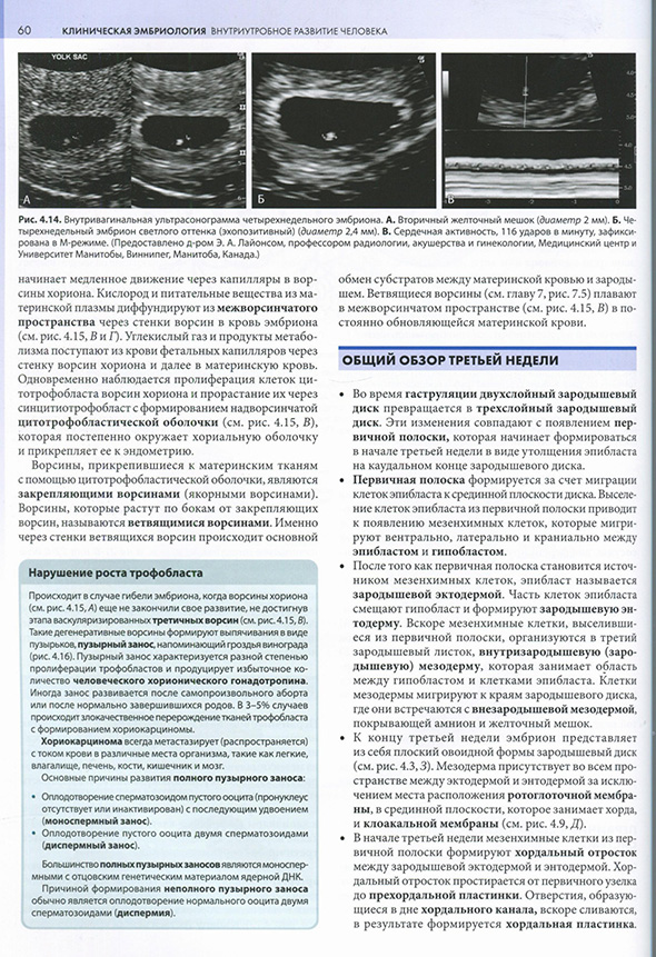 Внутривагинальная ультрасонограмма четырехнедельного эмбриона.