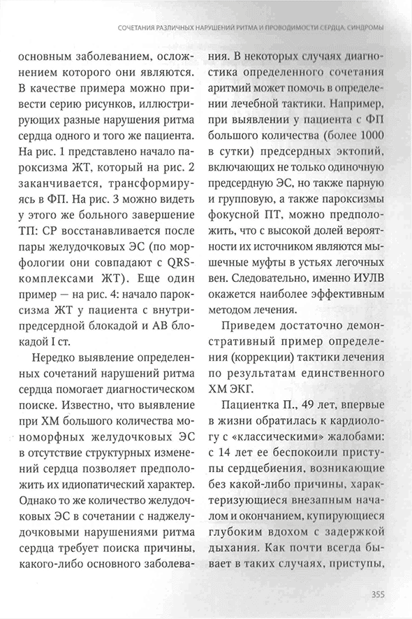 Пример страницы из книги "Холтеровское мониторирование при аритмиях" Пример страницы из книги "Холтеровское мониторирование при аритмиях"