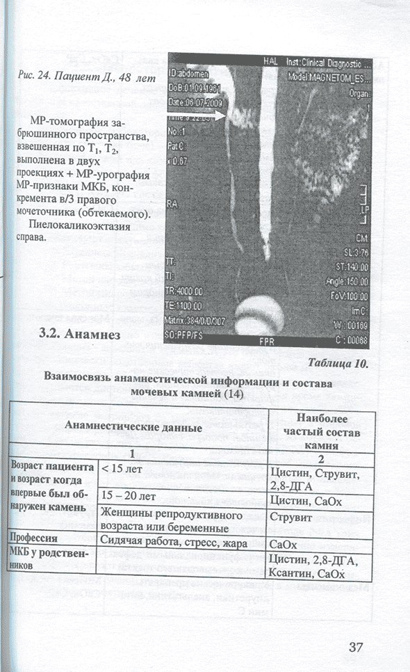 Взаимосвязь анамнестической информации и состава мочевых камней 