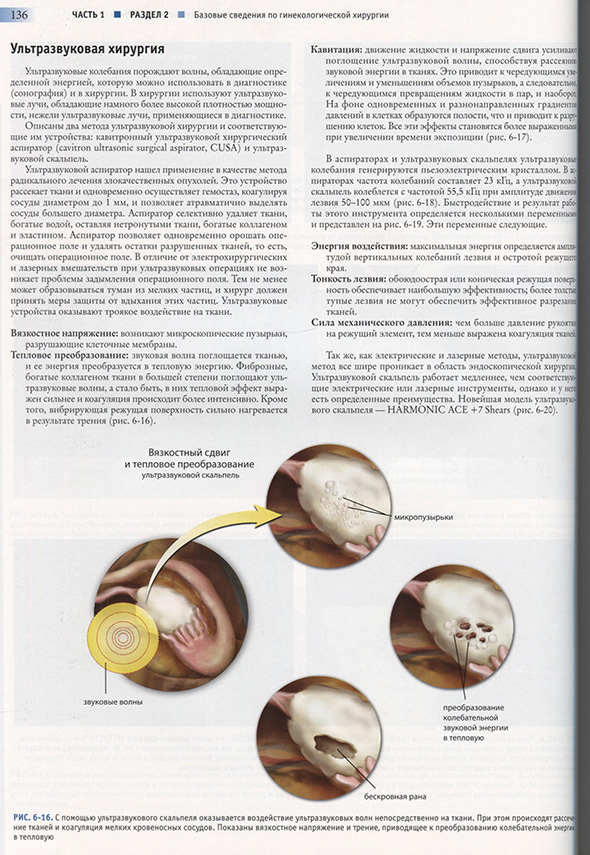 С помощью ультразвукового скальпеля оказывается воздействие ультразвуковых волн непосредственно на ткани. С помощью ультразвукового скальпеля оказывается воздействие ультразвуковых волн непосредственно на ткани.