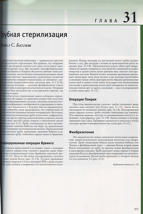 Трубная стерилизация Трубная стерилизация