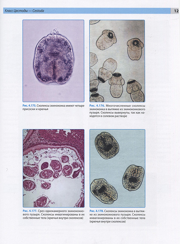Сколексы Сколексы