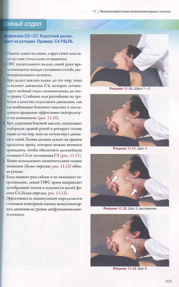 Дисфункции С2-С7.