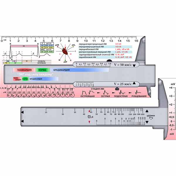 Информационно-справочная линейка ЭКГ-параметров предназначена для ускорения и облегчения анализа электрокардиограмм