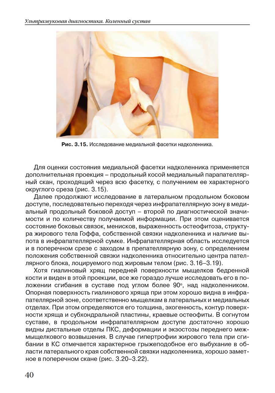 Рис. 3.15. Исследование медиальной фасетки надколенника Рис. 3.15. Исследование медиальной фасетки надколенника
