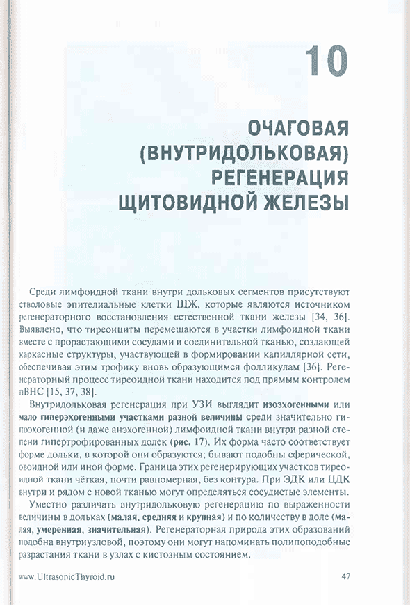 Пример страницы из книги "Ультразвуковая диагностика диффузных процессов щитовидной железы" - Ушаков А. В.