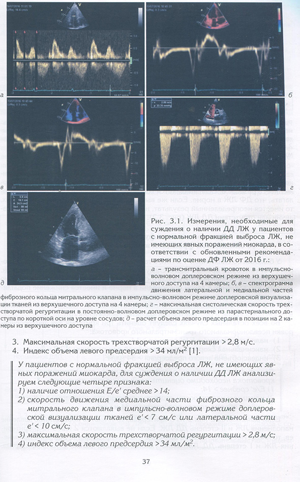 Измерения, необходимые для суждения о наличии ДД ЛЖ у пациентов с нормальной фракцией выброса ЛЖ