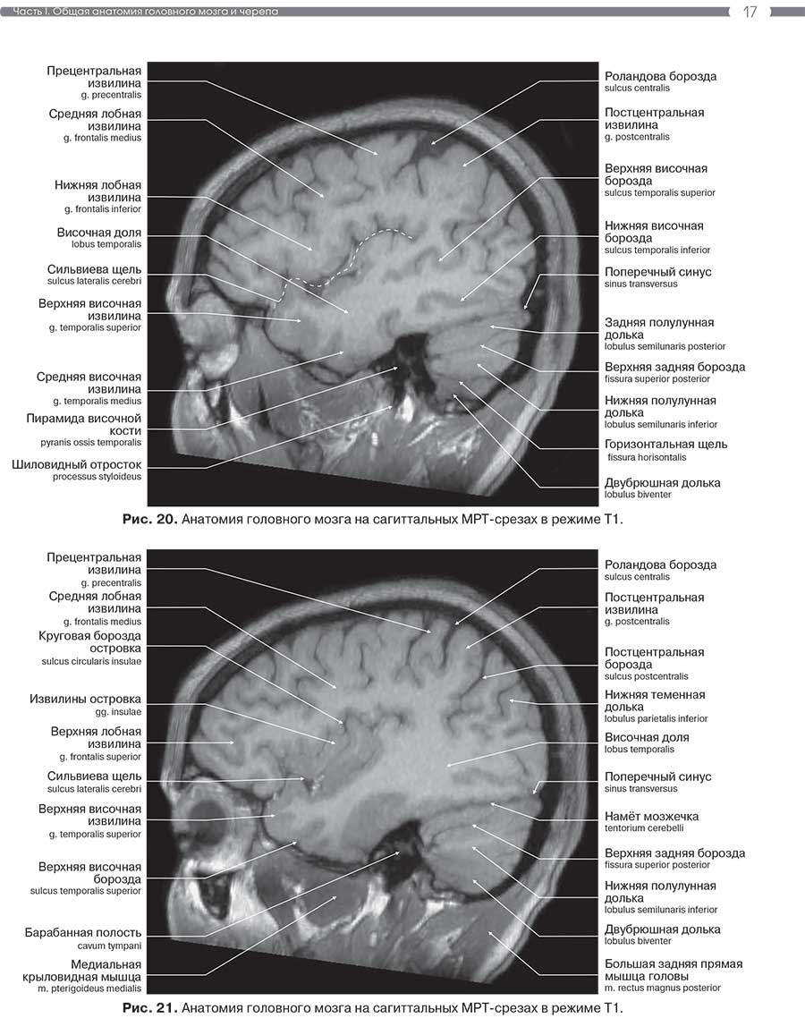 Рис. 21. Анатомия головного мозга на сагиттальных MPT-срезах в режиме Т1.