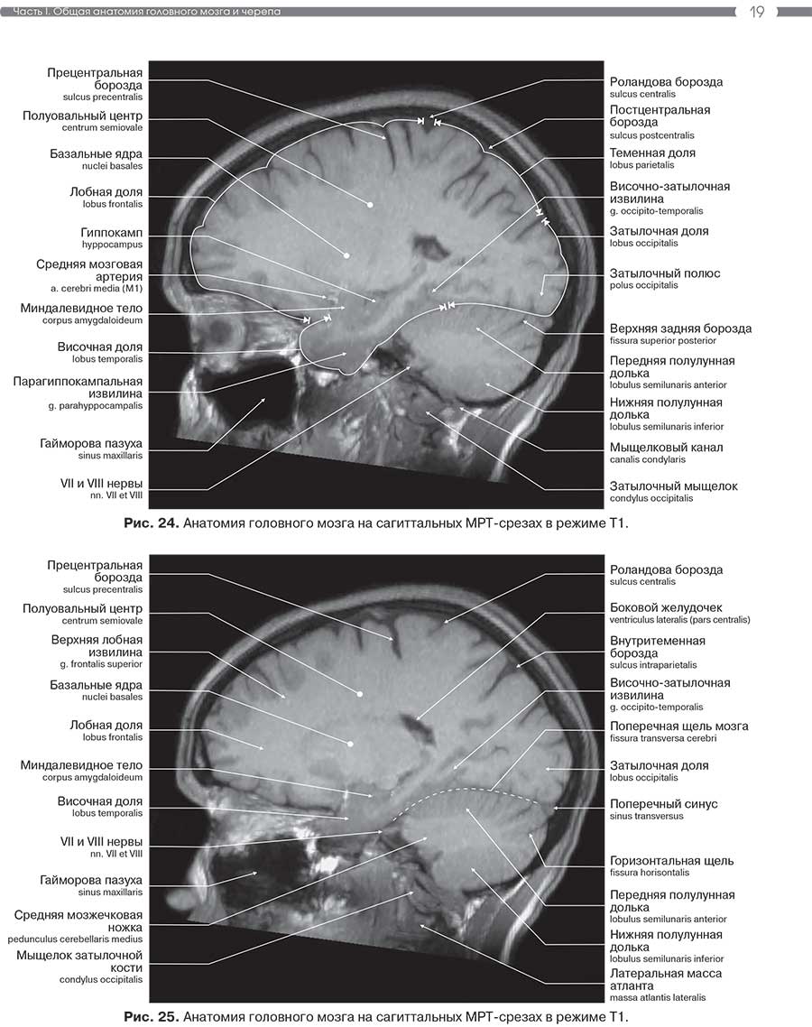 Рис. 25. Анатомия головного мозга на сагиттальных MPT-срезах в режиме Т1.