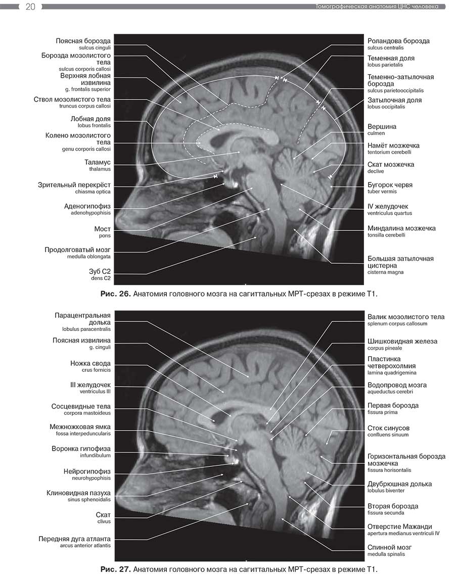 Рис. 27. Анатомия головного мозга на сагиттальных MPT-срезах в режиме Т1.